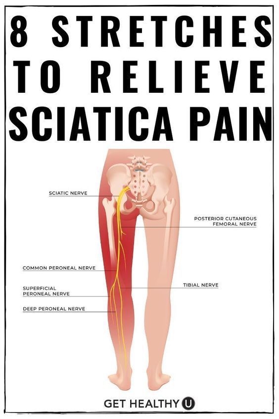 Download Sciatic nerve pain pictures 66 5a8ef552a0d368e10689108f85119d54