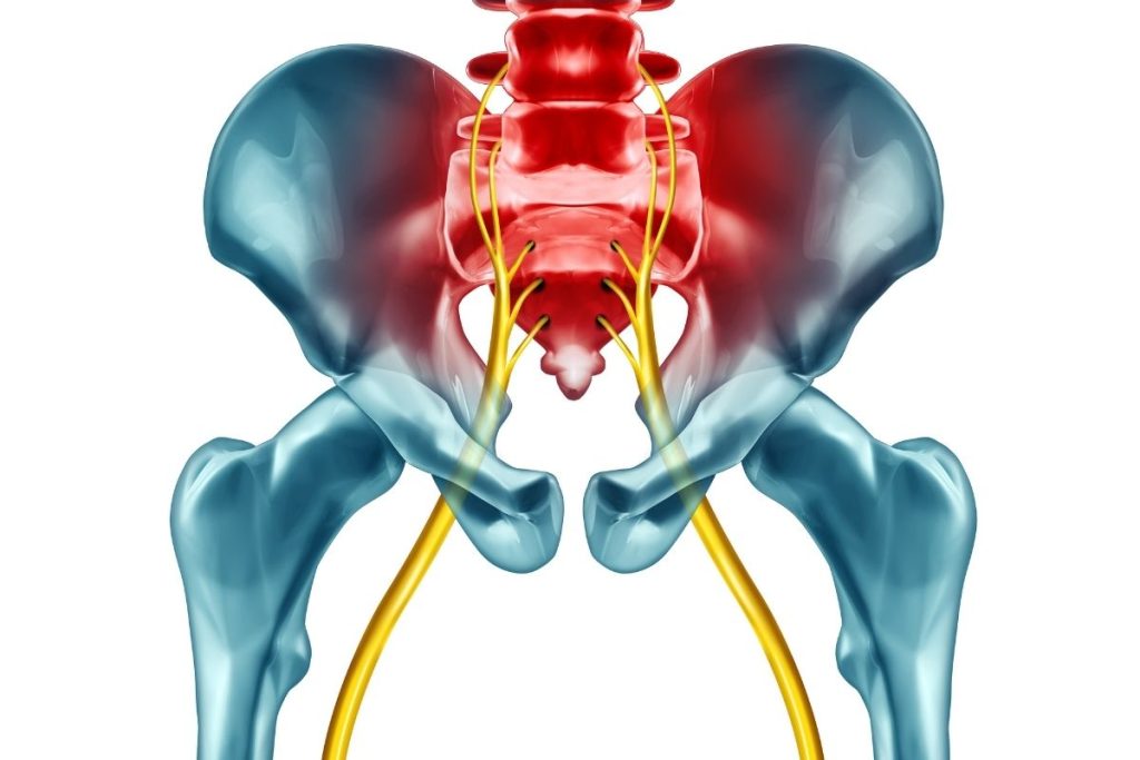 Download Sciatic nerve pain pictures 42 Sciatica3