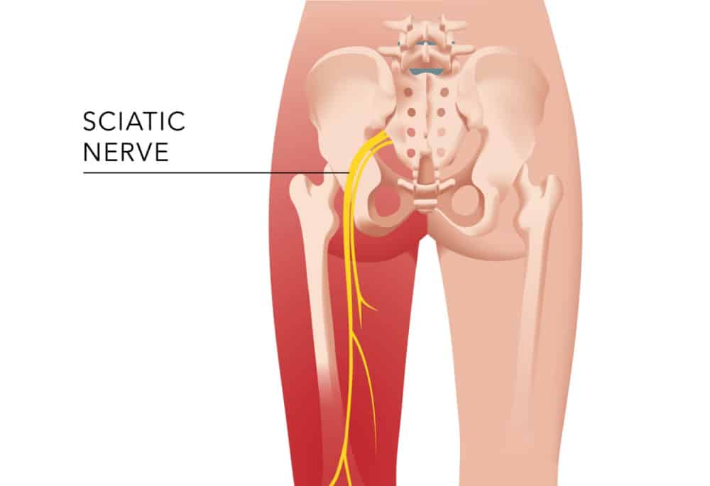 Download Sciatic nerve pain pictures 99 Shutterstock 1580328943