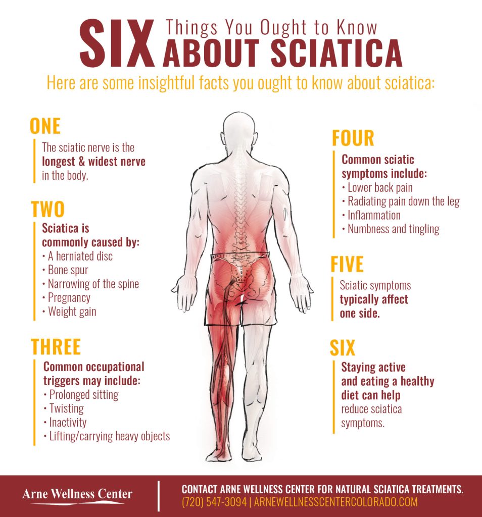 Download Sciatic nerve pain pictures 2 Six Things to Know About Sciatica Infographic 5f3584f97cce1
