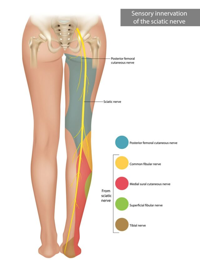 Download Sciatic nerve pain pictures 76 The Sciatic Nerve. Sensory innervation of the sciatic nerve. 640x853 1