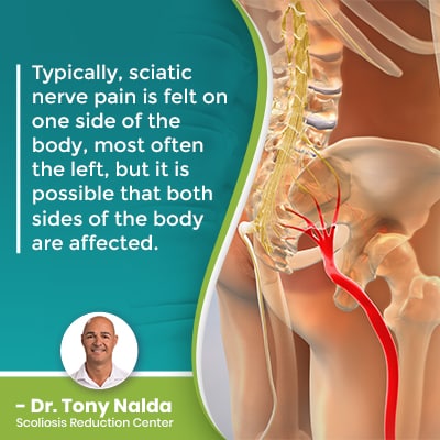 Download Sciatic nerve pain pictures 12 Typically sciatic nerve pain is 400
