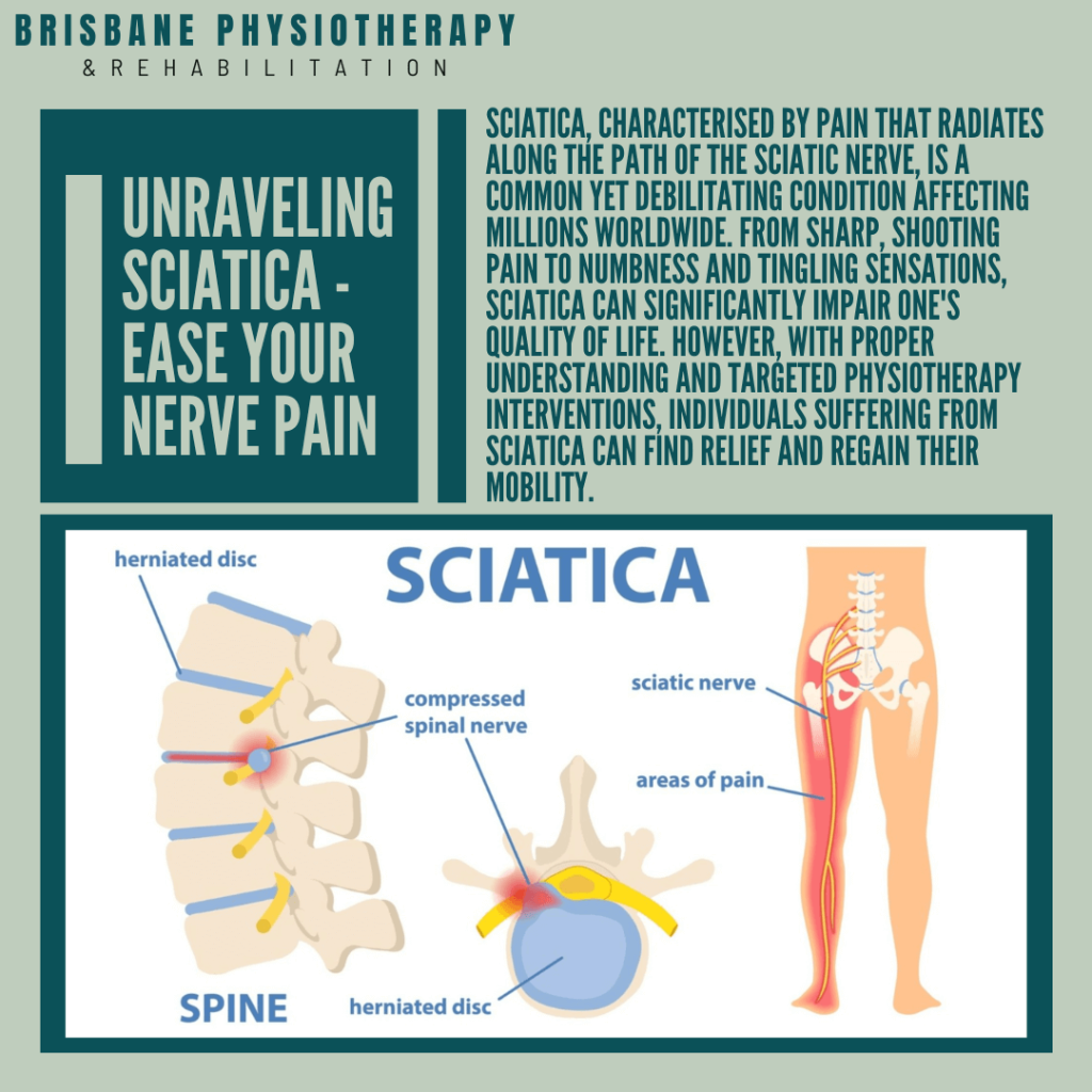 Download Sciatic nerve pain pictures 25 WhatisSciatica