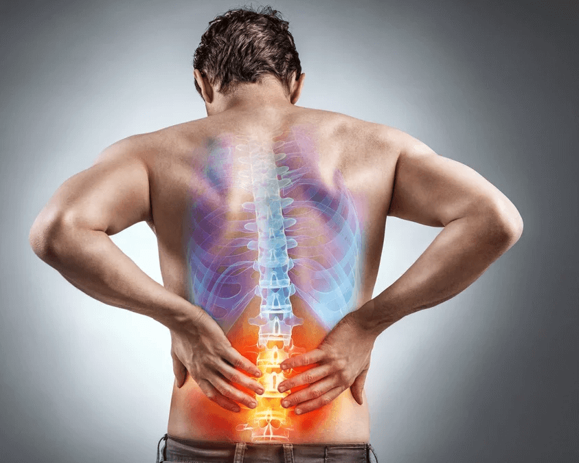 Download Sciatic nerve pain pictures 15 back