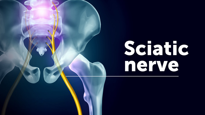 Download Sciatic nerve pain pictures 57 getty935673920 707x398 1