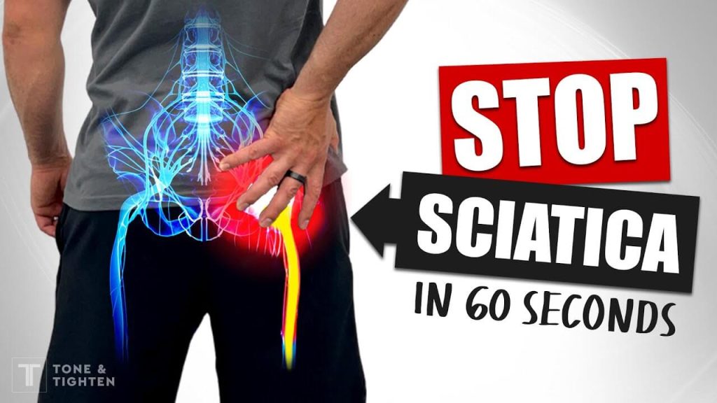 Download Sciatic nerve pain pictures 46 hq720
