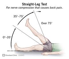 Download Sciatic nerve pain pictures 277 image21