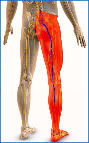 Download Sciatic nerve pain pictures 117 image34