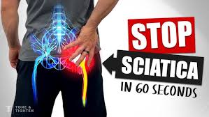 Download Sciatic nerve pain pictures 139 image42