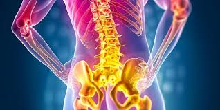 Download Sciatic nerve pain pictures 166 images105