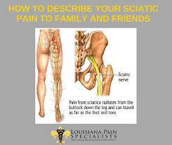 Download Sciatic nerve pain pictures 163 images107