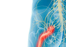 Download Sciatic nerve pain pictures 120 images111