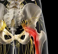 Download Sciatic nerve pain pictures 153 images117