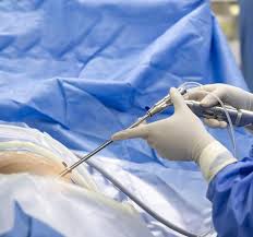Download Sciatic nerve pain pictures 252 images119