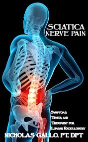 Download Sciatic nerve pain pictures 116 images122