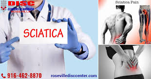 Download Sciatic nerve pain pictures 107 images123