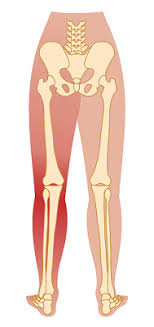Download Sciatic nerve pain pictures 243 images127