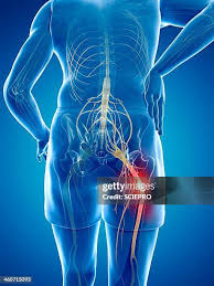 Download Sciatic nerve pain pictures 104 images128