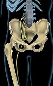 Download Sciatic nerve pain pictures 158 images130