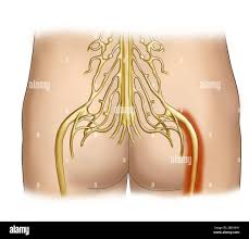 Download Sciatic nerve pain pictures 310 images131