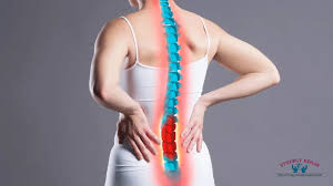 Download Sciatic nerve pain pictures 291 images132