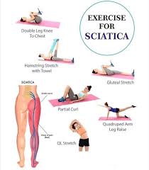 Download Sciatic nerve pain pictures 264 images137