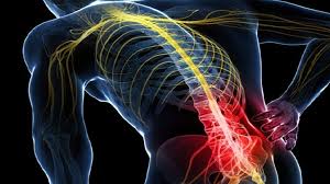 Download Sciatic nerve pain pictures 145 images140