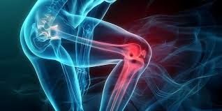Download Sciatic nerve pain pictures 229 images148
