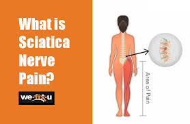 Download Sciatic nerve pain pictures 194 images149