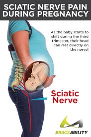 Download Sciatic nerve pain pictures 165 images153