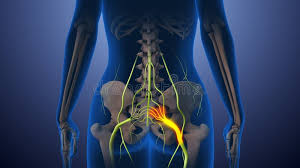Download Sciatic nerve pain pictures 195 images154