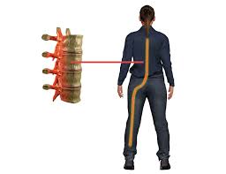 Download Sciatic nerve pain pictures 375 images159