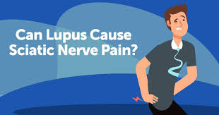 Download Sciatic nerve pain pictures 206 images160
