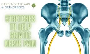 Download Sciatic nerve pain pictures 207 images162