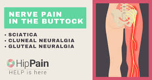 Download Sciatic nerve pain pictures 143 images164