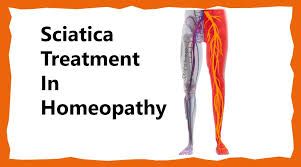 Download Sciatic nerve pain pictures 179 images166