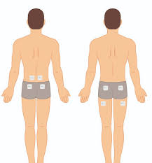 Download Sciatic nerve pain pictures 299 images169