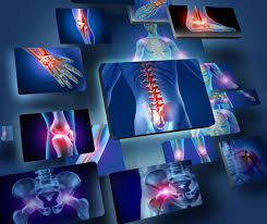 Download Sciatic nerve pain pictures 114 images170