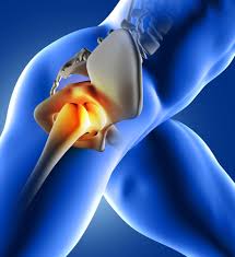 Download Sciatic nerve pain pictures 265 images171