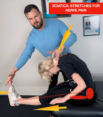 Download Sciatic nerve pain pictures 130 images173