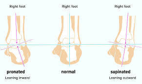 Download Sciatic nerve pain pictures 253 images175