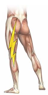 Download Sciatic nerve pain pictures 345 images180