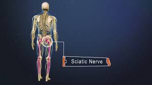 Download Sciatic nerve pain pictures 376 images182