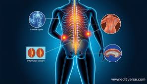 Download Sciatic nerve pain pictures 205 images194