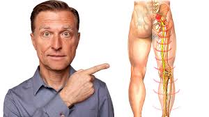 Download Sciatic nerve pain pictures 269 images207