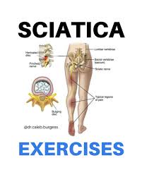 Download Sciatic nerve pain pictures 268 images210