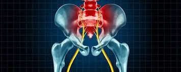 Download Sciatic nerve pain pictures 249 images211