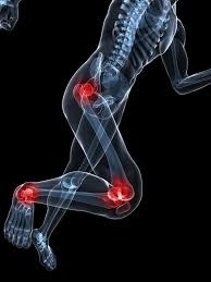 Download Sciatic nerve pain pictures 297 images213