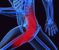 Download Sciatic nerve pain pictures 168 images218