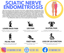 Download Sciatic nerve pain pictures 96 images219